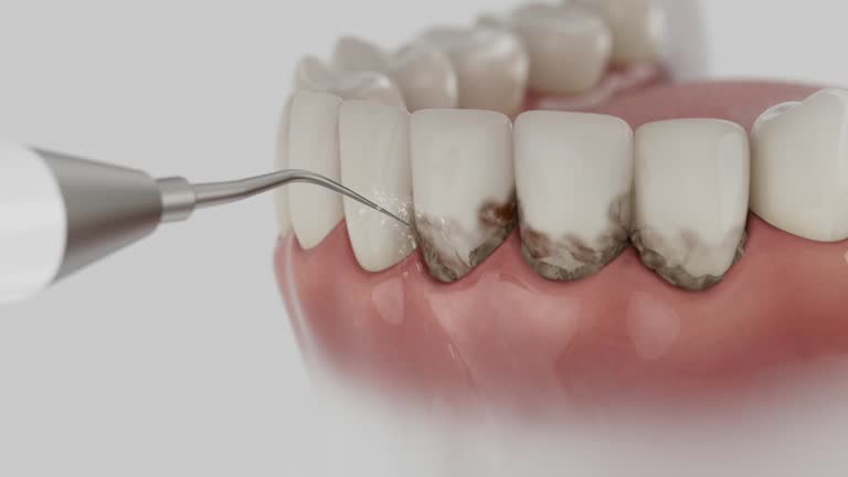 Trusted Dental Implants service in El Reno, OK - Dentist Open Now